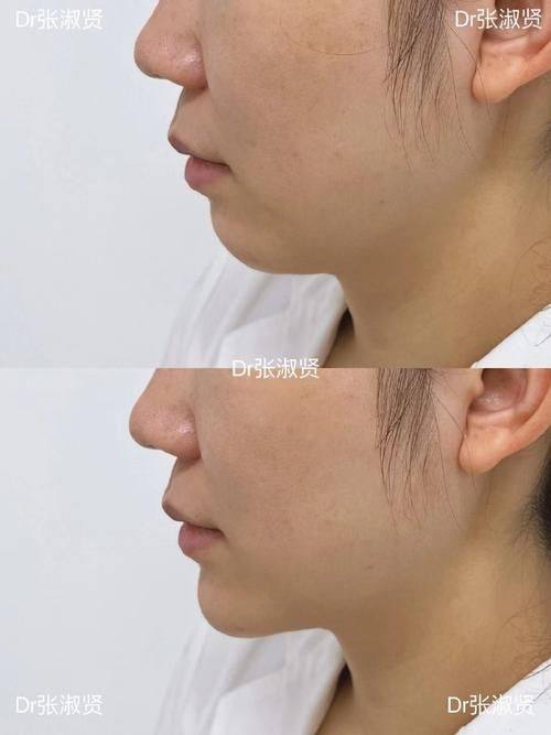 常州花泰美医疗美容诊所特色项目及技术优势