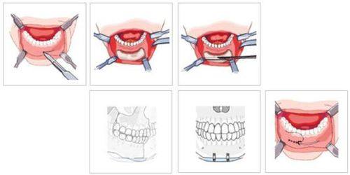 常州花泰美医疗美容诊所真人口碑评价怎么样？