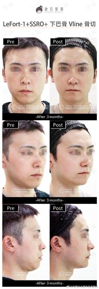 常州花泰美医疗美容诊所是正规医院吗？