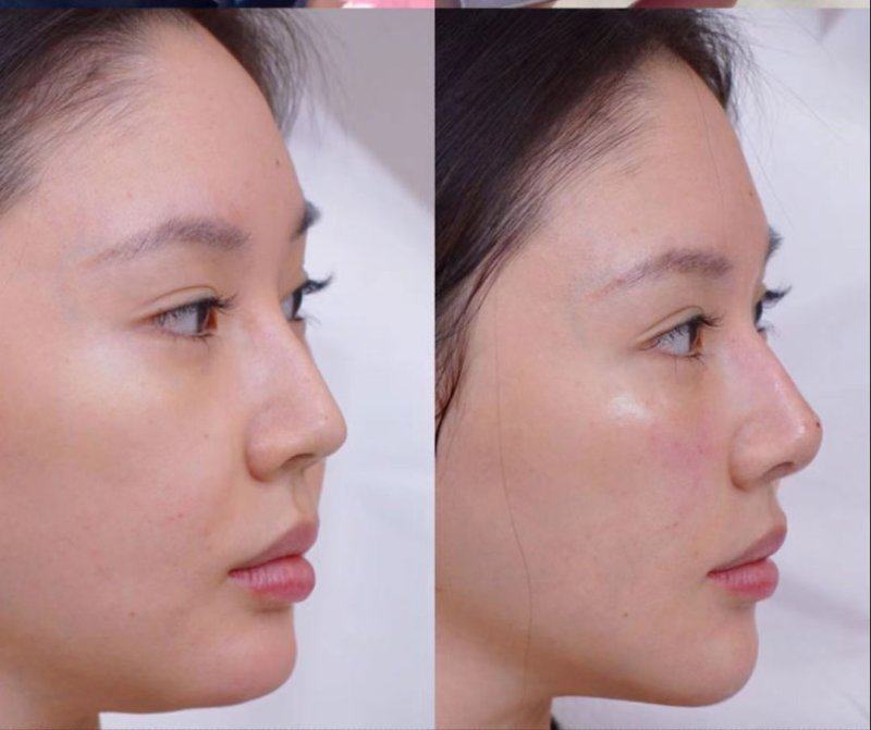 天津雅韵医疗美容门诊详细的预约挂号方式及流程