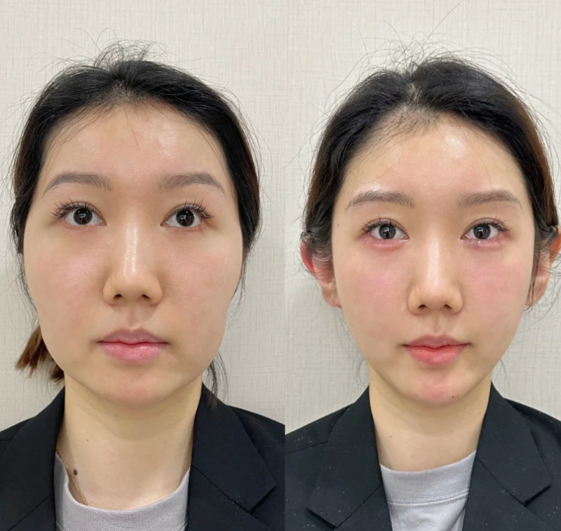 黄文博医生价格表