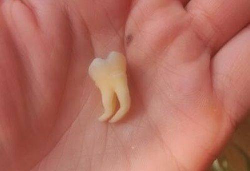 周念医生擅长项目