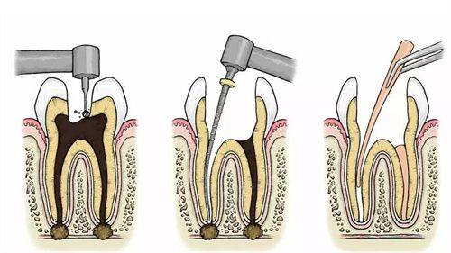 李嘉琪医生口碑评价及真人实例