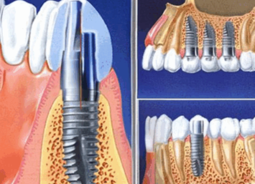 康健医生技术优势