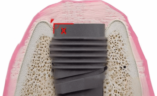 方丽医生技术优势