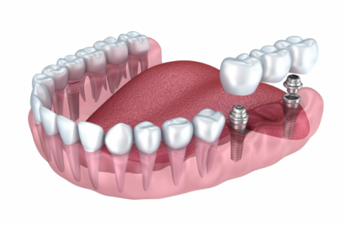 湖州德清武康沈云祥牙科诊所详细的预约挂号方式及流程