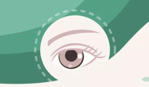 常熟威沃眼科诊所真人口碑评价怎么样？