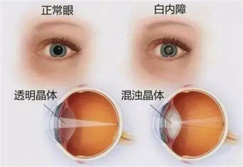 天水博视眼科医院地址电话营业时间