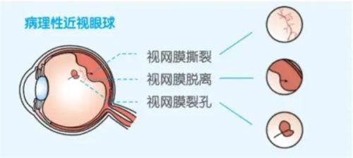 常熟威沃眼科诊所详细的预约挂号方式及流程