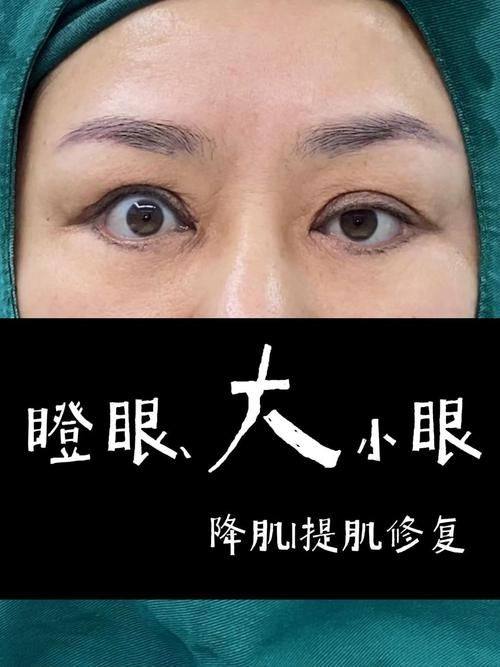 淮安苏莱美医疗美容门诊是正规医院吗？