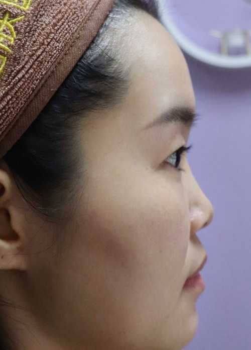 宜兴市中医和西医结合医院医疗美容科详细的预约挂号方式及流程