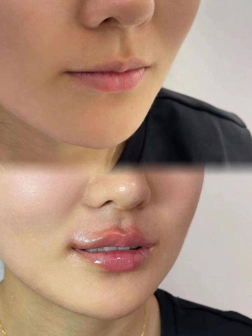 韩国ARUMP LINE整形外科特色项目及技术优势