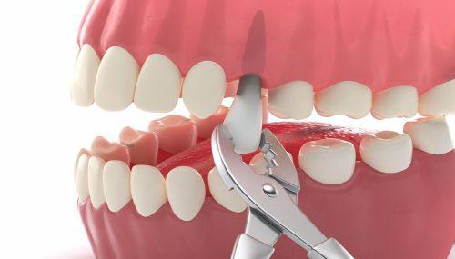 厦门思明华美医容医疗美容（口腔科）医生团队实力强大及骨干医生简介