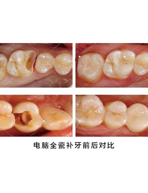 平顶山诺德口腔医院详细的预约挂号方式及流程