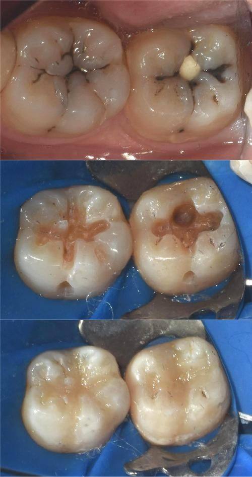 深圳好佰年口腔门诊部详细的预约挂号方式及流程