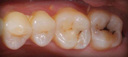 平顶山诺德口腔医院收费价格表/收费标准