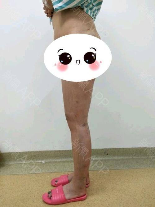 宜兴市中医和西医结合医院医疗美容科是正规医院吗？