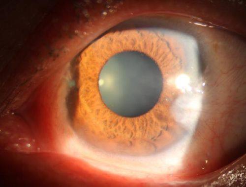 天水博视眼科医院真人口碑评价怎么样？