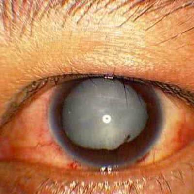 天水博视眼科医院特色项目及技术优势