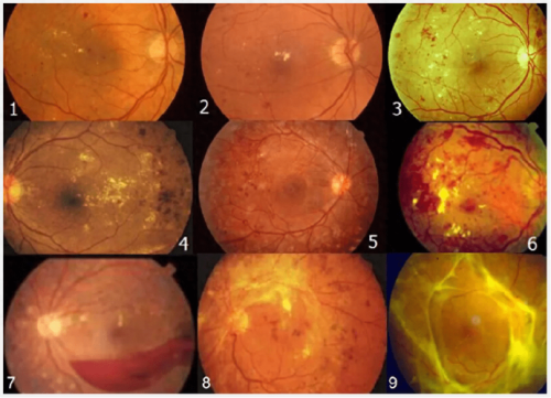 南通市第四人民医院眼科特色项目及技术优势