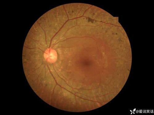 南通市第四人民医院眼科收费价格表/收费标准