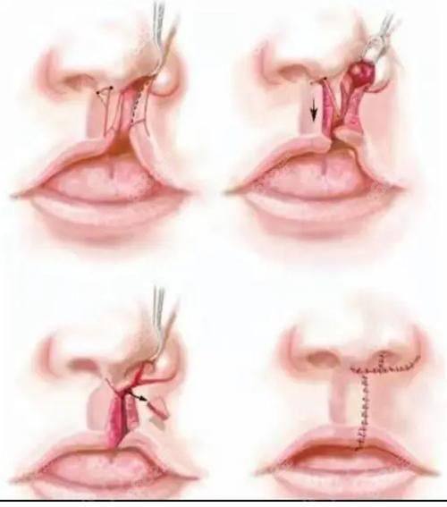 韩国ARUMP LINE整形外科地址电话营业时间