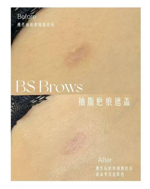 长沙煌美整形疗美容医院详细的预约挂号方式及流程