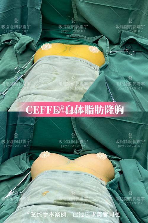 北京美清国内外医疗整形医院详细的预约挂号方式及流程