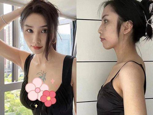 长沙煌美整形疗美容医院真人口碑评价怎么样？