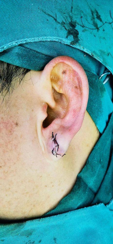 长沙煌美整形疗美容医院收费价格表/收费标准