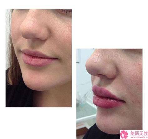 福州新时代整形医院收费价格表/收费标准