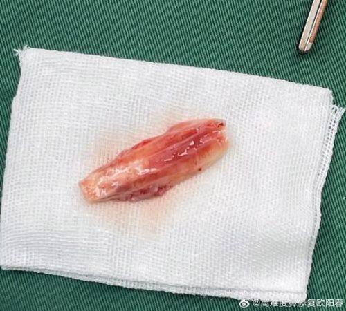 新乡王贺宾整形医疗美容诊所真人口碑评价怎么样？