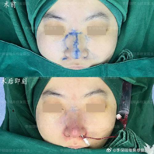 福州新时代整形医院是正规医院吗？