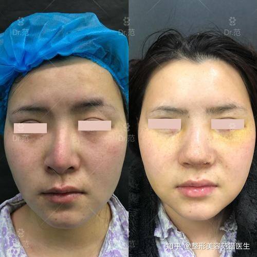 福州新时代整形医院真人口碑评价怎么样？