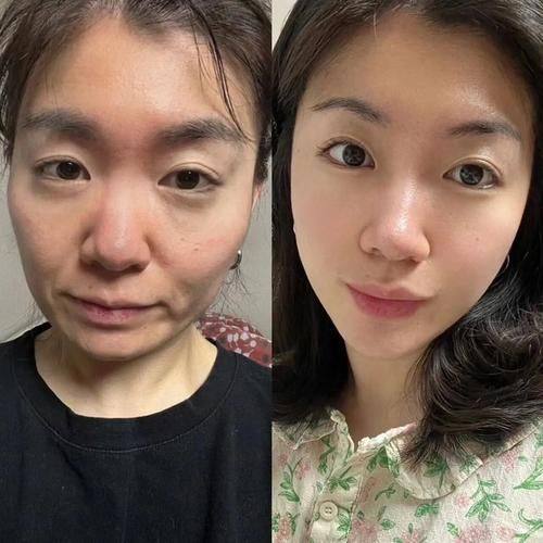 淮安苏莱美医疗美容门诊真人口碑评价怎么样？