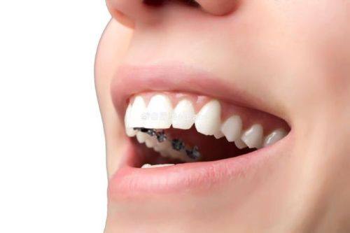 深圳好佰年口腔门诊部真人口碑评价怎么样？