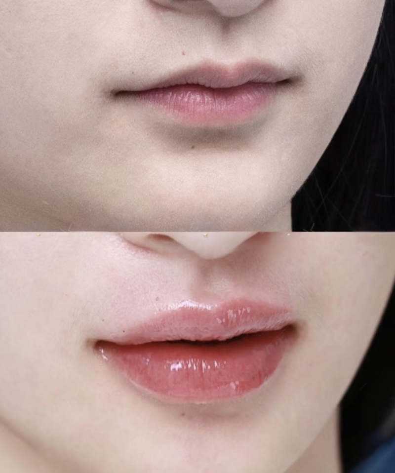 韩国ARUMP LINE整形外科是正规医院吗？