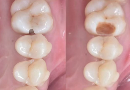 王淼医生口碑评价及真人实例