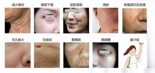 吴亮医生擅长项目