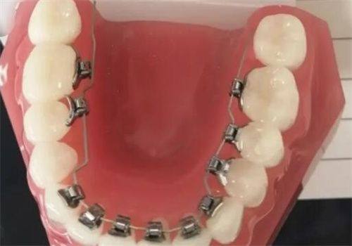 重庆贝瓷棠哲口腔门诊部详细的预约挂号方式及流程