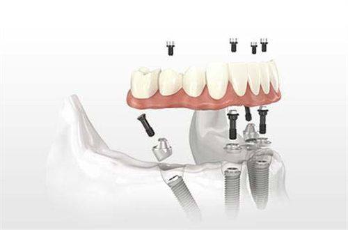 袁惠玲医生擅长项目