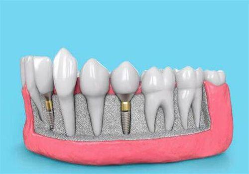 袁惠玲医生预约挂号