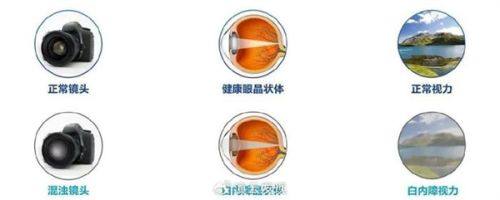 广西国内外壮医医院眼科真人口碑评价怎么样?