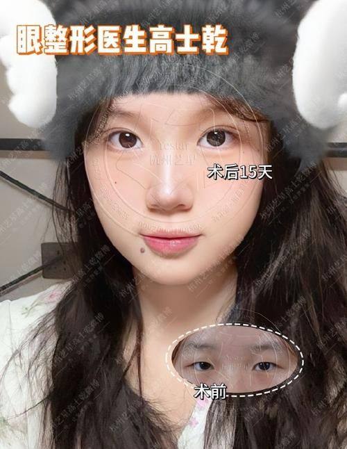 杨廷医生预约挂号