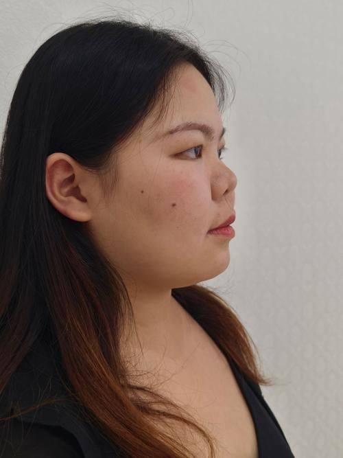 石家庄面容管家医疗美容收费价格表/收费标准