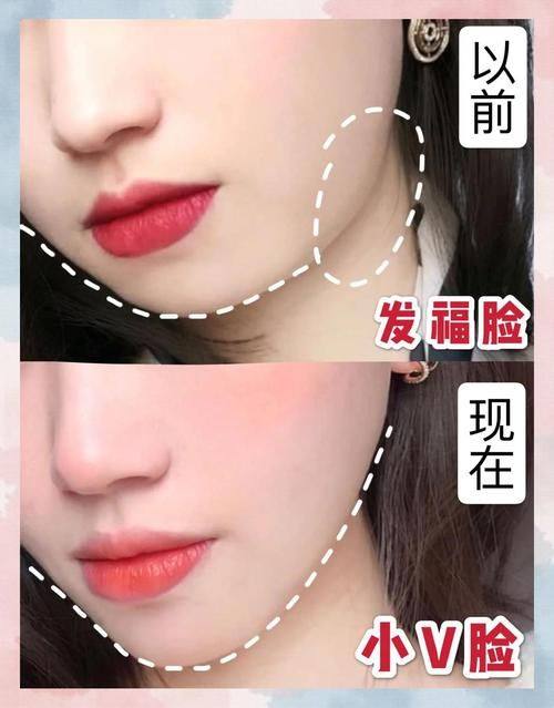 滕州艺美整形医院特色项目及技术优势