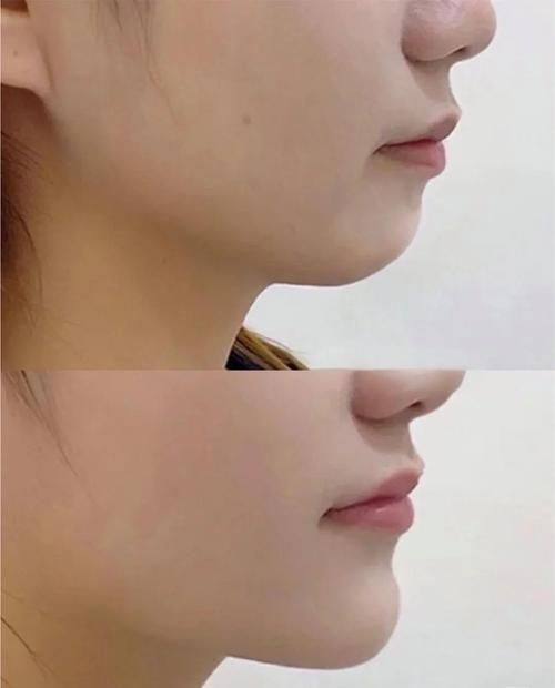 石家庄艾麦德医疗美容整形医院真人口碑评价怎么样？