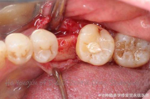 口碑评价及真人实例