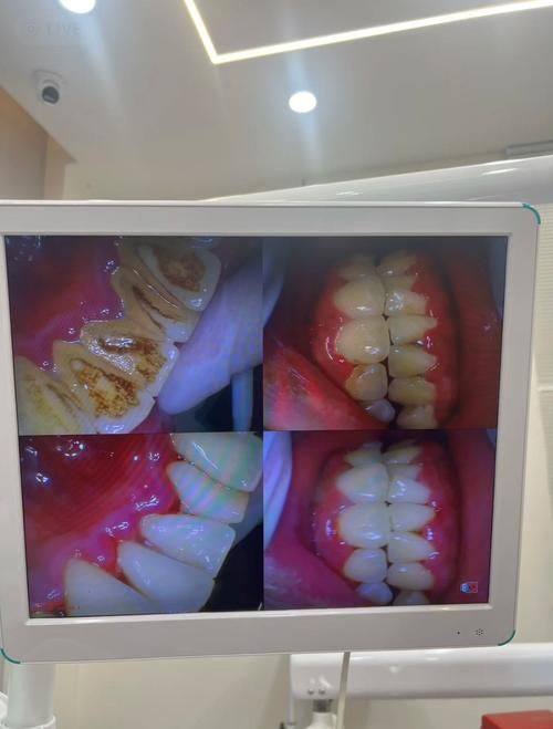 济南天真口腔诊所真人口碑评价怎么样？