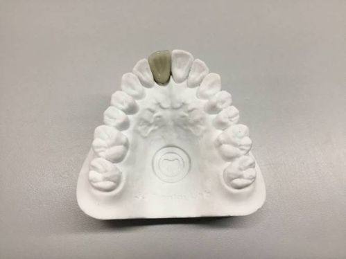 梁亚涵医生口碑评价及真人实例